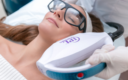 IPL Intense Pulsed Light for Pigmentation Removal