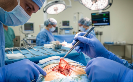 Types of Tissue Forceps Used in Medical Practice