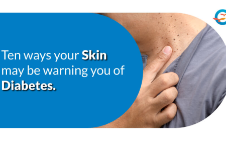 10 Ways Your Skin May Be Warning You of Diabetes