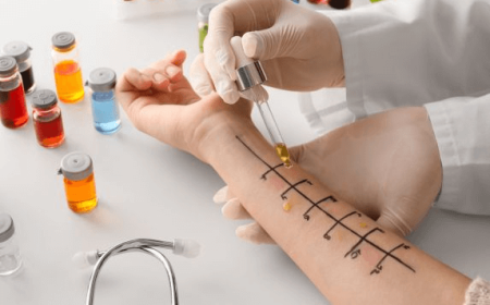 Choosing the Best Allergist in Dubai for Allergy Care