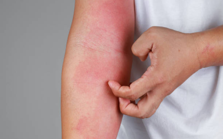 Best Skin Rashes Treatment in Dubai for All Skin Types