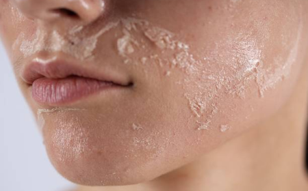 Inno Peeling in Dubai: Long-Term Maintenance and Results