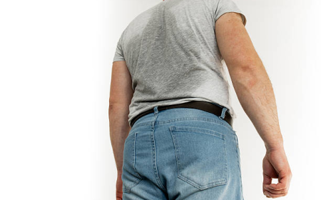 Future-Ready Hyperhidrosis Treatment in Dubai