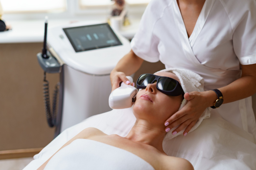 Laser vs. Peels – Best Option for Melasma in Manchester