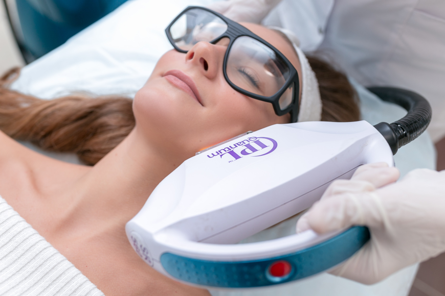 IPL Intense Pulsed Light for Pigmentation Removal