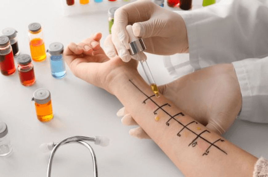 Choosing the Best Allergist in Dubai for Allergy Care
