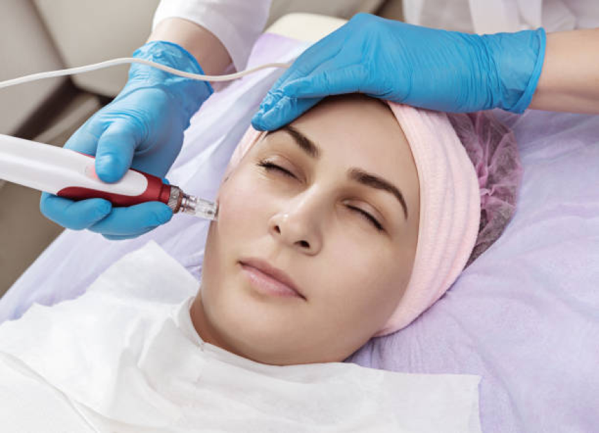 Dermapen Treatment in Dubai for Surgical & Injury Scars: Advanced Repair