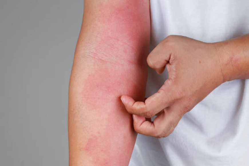 Best Skin Rashes Treatment in Dubai for All Skin Types