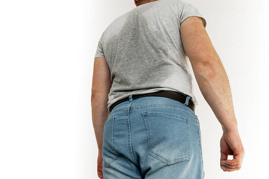 Future-Ready Hyperhidrosis Treatment in Dubai
