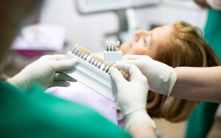 Same-Day Dental Crowns: Are They Available in Brampton?
