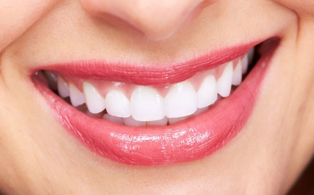 Tooth Crown Dubai: Step-by-Step Procedure Explained