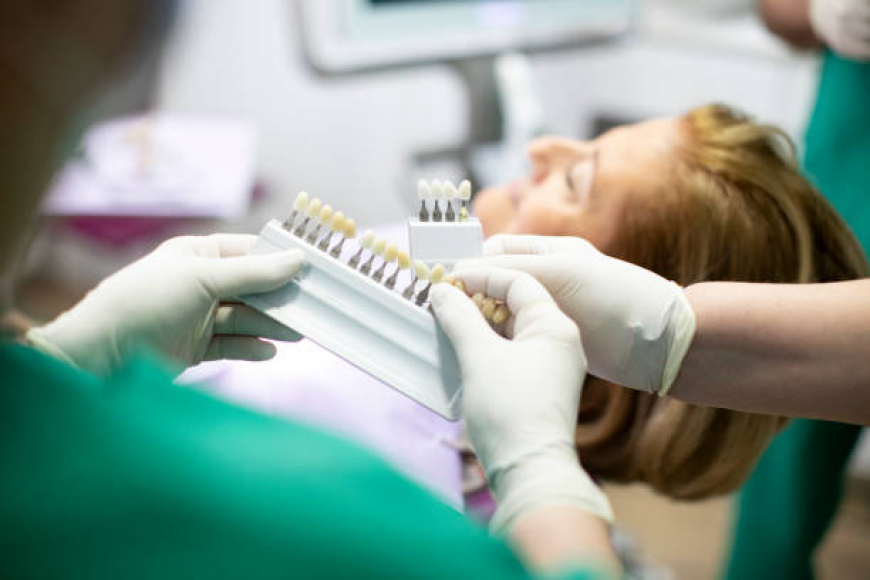 Same-Day Dental Crowns: Are They Available in Brampton?