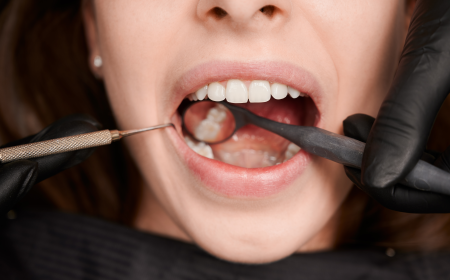 Understanding Crown Lengthening and Its Benefits for Oral Health
