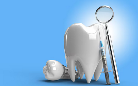 Your Smile Awaits Things to Know Before Visiting an Expert Implant Dentist