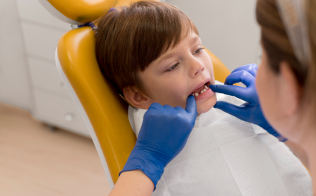 Why Treating Cavities Early With Pediatric Teeth Fillings Matters