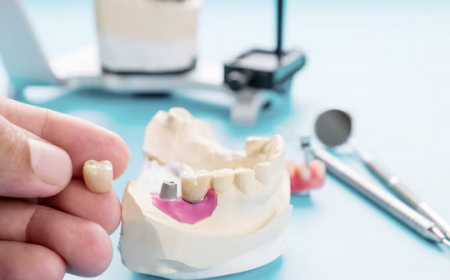 Dental Bridges the Gap: Restore Chewing Function