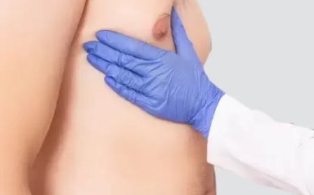 The Benefits of Gynecomastia Surgery for Men