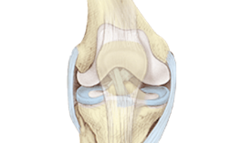 Anterior Cruciate Ligament Injuries Market Growth Driven by Surgical Innovations