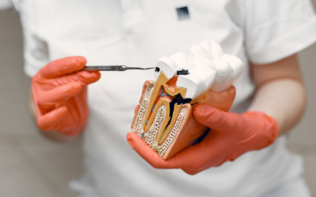 The Truth About Root Canals: What to Expect from Root Canal Treatment in Raleigh, NC