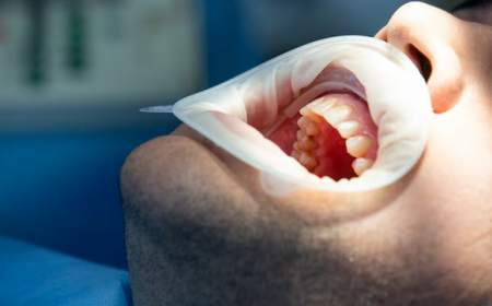 Restorative and Cosmetic Solutions: Unveiling the Benefits of Full Mouth Restoration