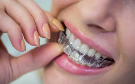 Can Clear Aligners Fix Severe Orthodontic Problems?