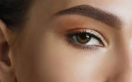 تجميل الجفون الرياض: مراحل التورم والشفاء بعد العملية