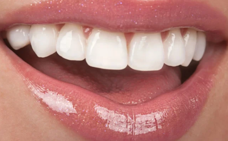 Remove Stains and Brighten Your Smile with West Houston Teeth Whitening