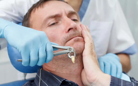 Wisdom Teeth Removal Franklin KY: Safe and Comfortable Extraction Services