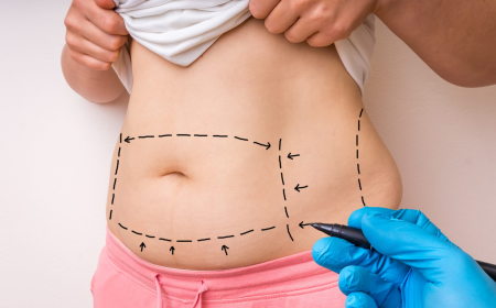 Why Dubai Is a Popular Destination for Mommy Makeover Surgery