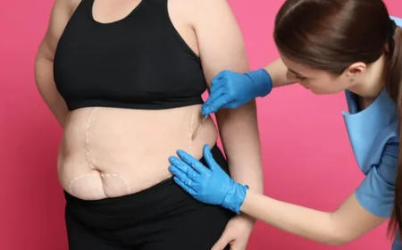 Who Qualifies for Bariatric Surgery in Islamabad? Eligibility Criteria Explained