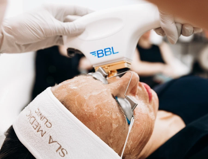 BBL Laser In Manchester – Advanced Skin Rejuvenation Treatment