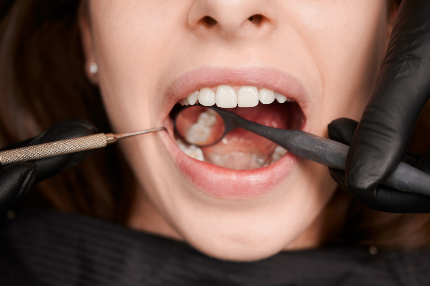 Understanding Crown Lengthening and Its Benefits for Oral Health