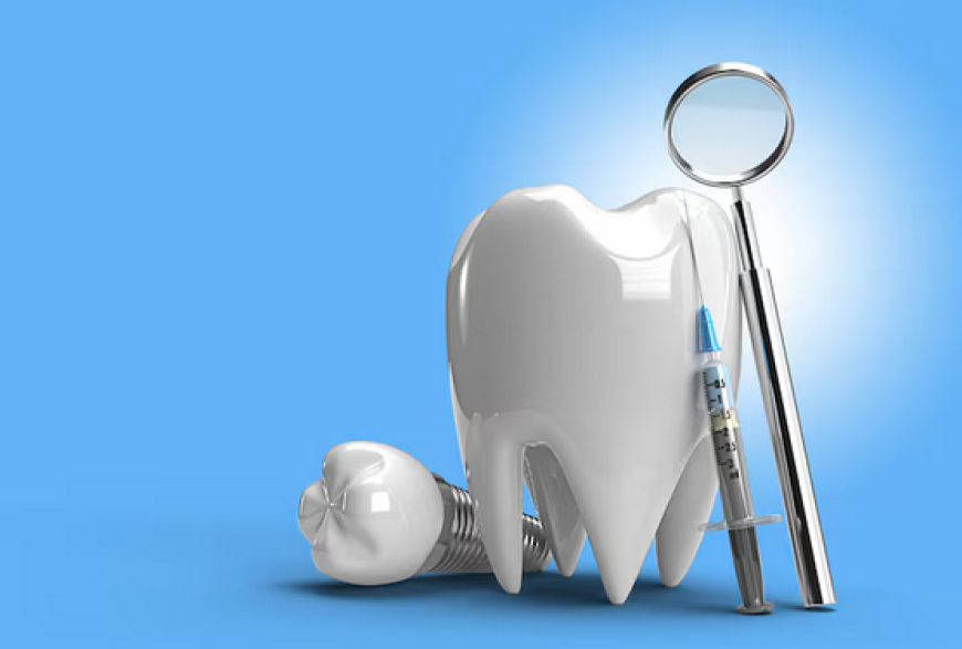Your Smile Awaits Things to Know Before Visiting an Expert Implant Dentist