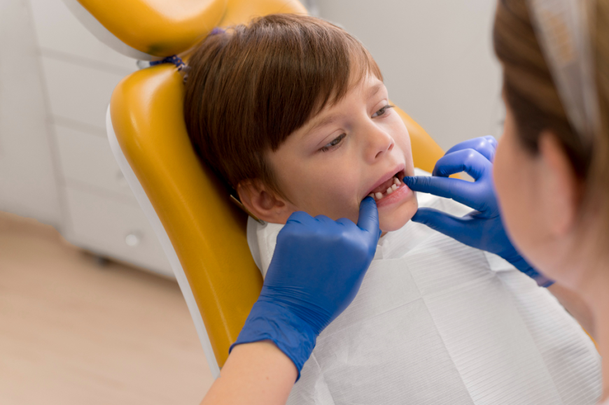 Why Treating Cavities Early With Pediatric Teeth Fillings Matters