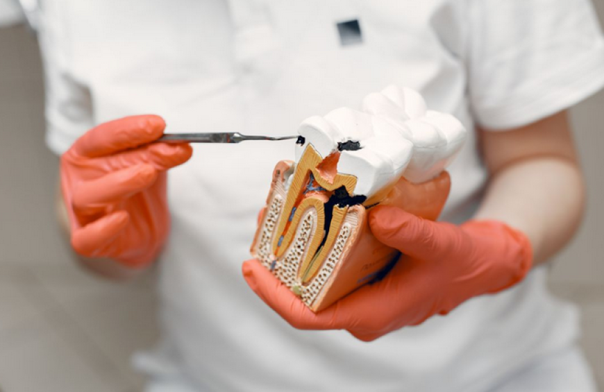 The Truth About Root Canals: What to Expect from Root Canal Treatment in Raleigh, NC