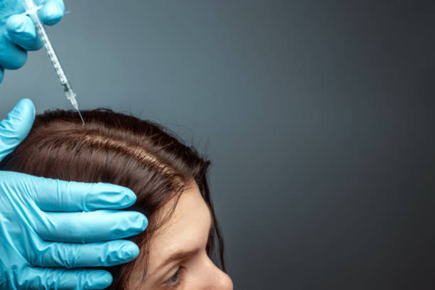 Exosome Hair Restoration: A New Era for Scalp Health Dubai