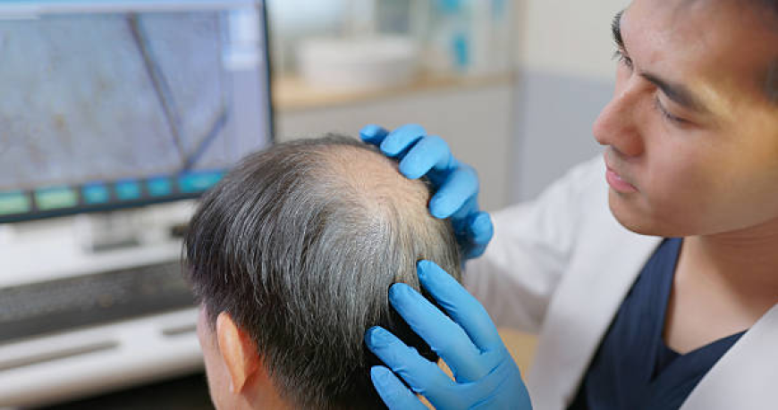 Beard and Mustache Hair Transplant in Dubai Guide