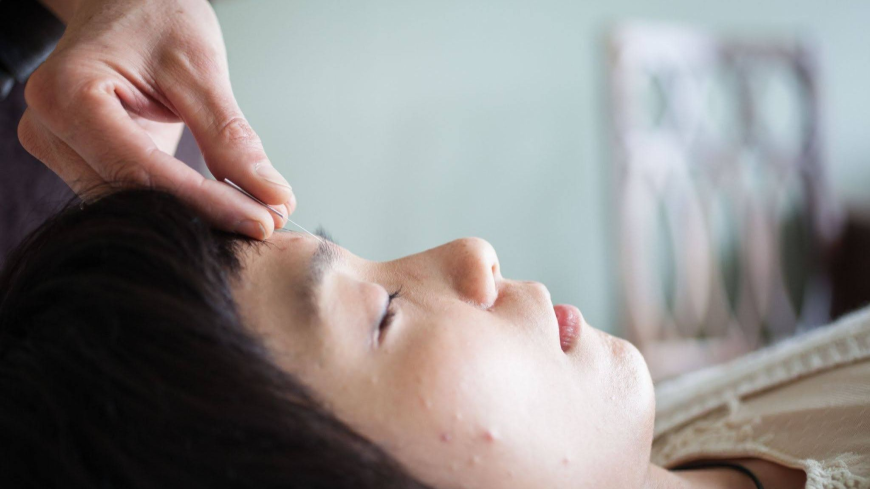 Oakland Acupuncture Clinic: Your First Facial Session