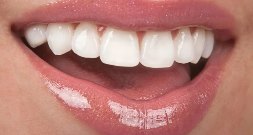 Remove Stains and Brighten Your Smile with West Houston Teeth Whitening