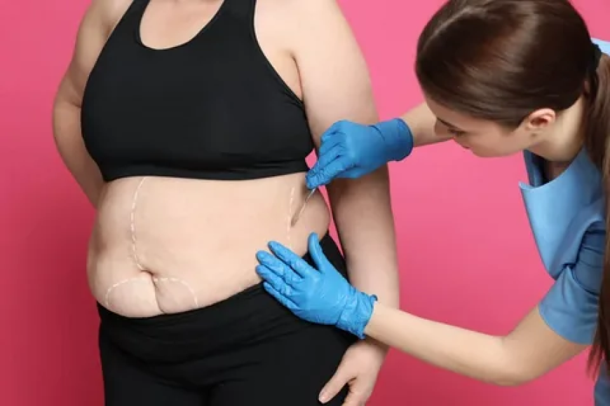 Who Qualifies for Bariatric Surgery in Islamabad? Eligibility Criteria Explained