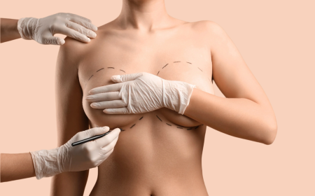 Mia Breast Implant In Dubai: Modern Breast Enhancement with Faster Recovery