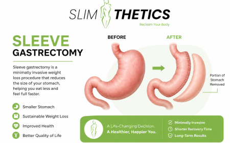 How Soon Will You Notice Results After Sleeve Gastrectomy in Islamabad?