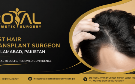 Best Hair Transplant Surgeon for Modern Hair Transplant Technology