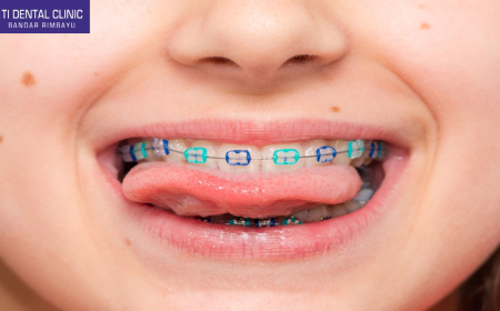 Selangor Orthodontic Cost Guide: Private vs. Public Options, Factors, and Payment Frameworks