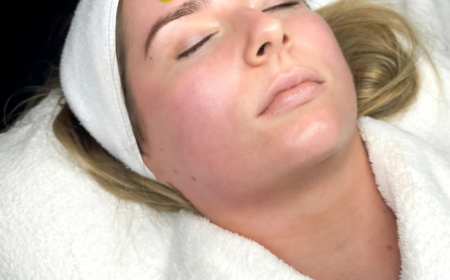 Biorepeel In Manchester – Innovative Chemical Peel Treatment for Fresh and Radiant Skin