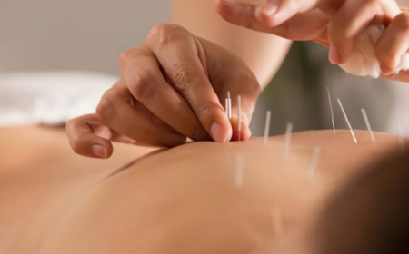 5 Tips for Getting the Most Out of Your Acupuncture