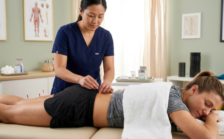 Solving Recovery and Performance Challenges with Acupuncture for Athletes