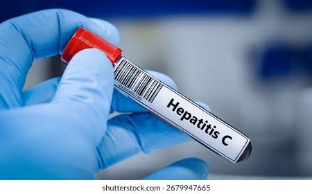 Hepatitis B and C Test Price in Lahore | Reliable Liver Health Screening