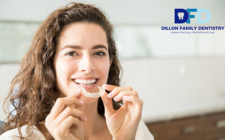 Missed Your Invisalign? What to Do Next | Bryn Mawr Dental