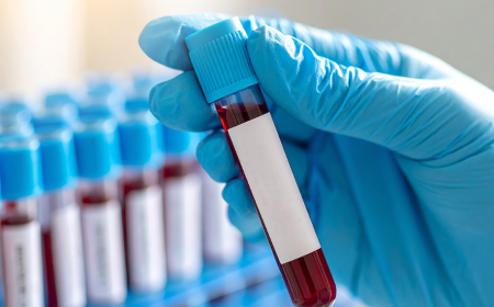 Hemogram Test: Purpose, Procedure, Preparation, Results & Benefits